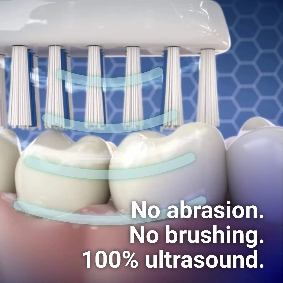 Electric Ultrasonic Toothbrush Set with Gentle 100% Ultrasound Cleaning Technology. Ideal for Sensitive Teeth & Gums, Plaque Removal and More! Includes Nano-Bubble Toothpaste. Rechargeable.