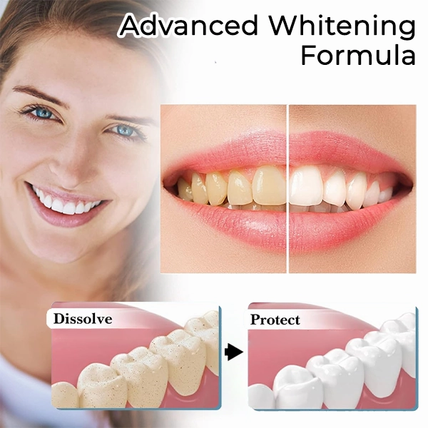 Fivfivgo™ Brilliance Soda Whitening Toothpaste