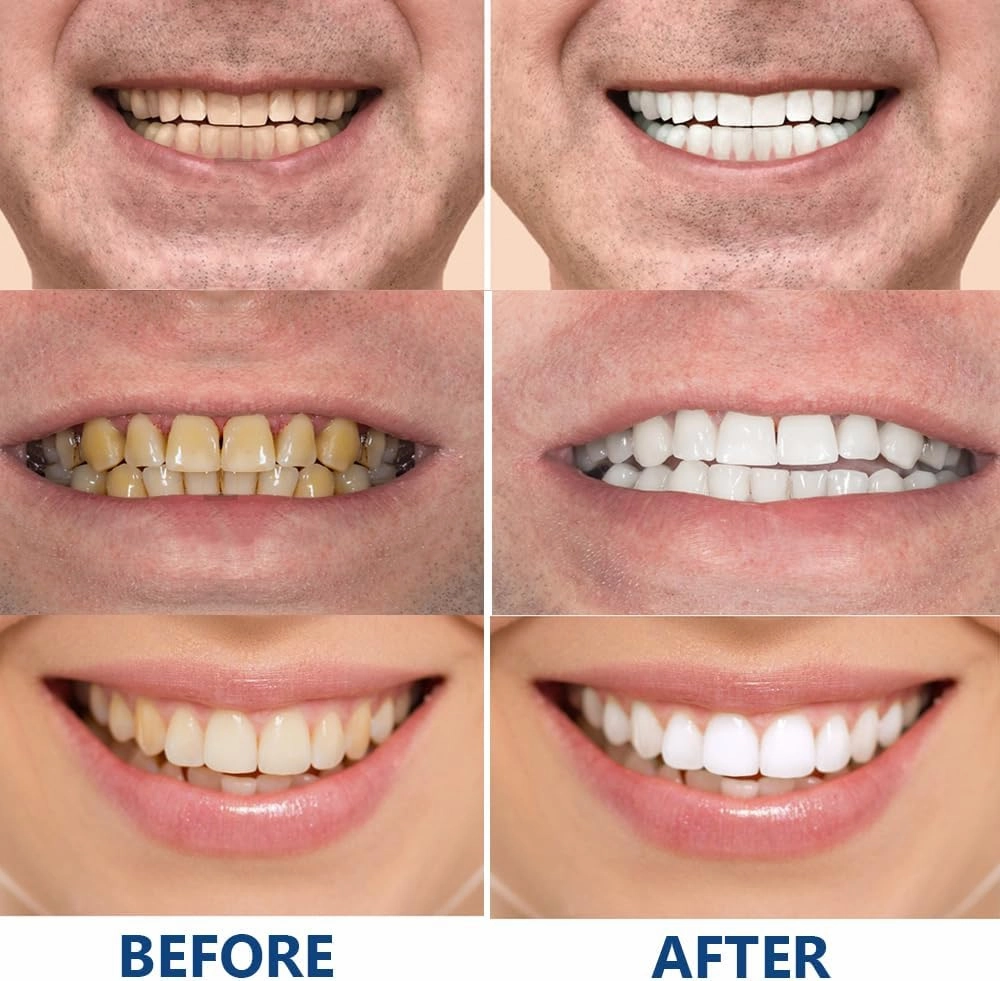 Geelike Hydroxyapatite Toothpaste,Nano Hydroxyapatite Repair & Protect Toothpaste, 7.5% Fluoride-Free Hydroxyapatite Enamel Repairing Breath Freshening Whitening toothpastes (2PCS-A, Large)