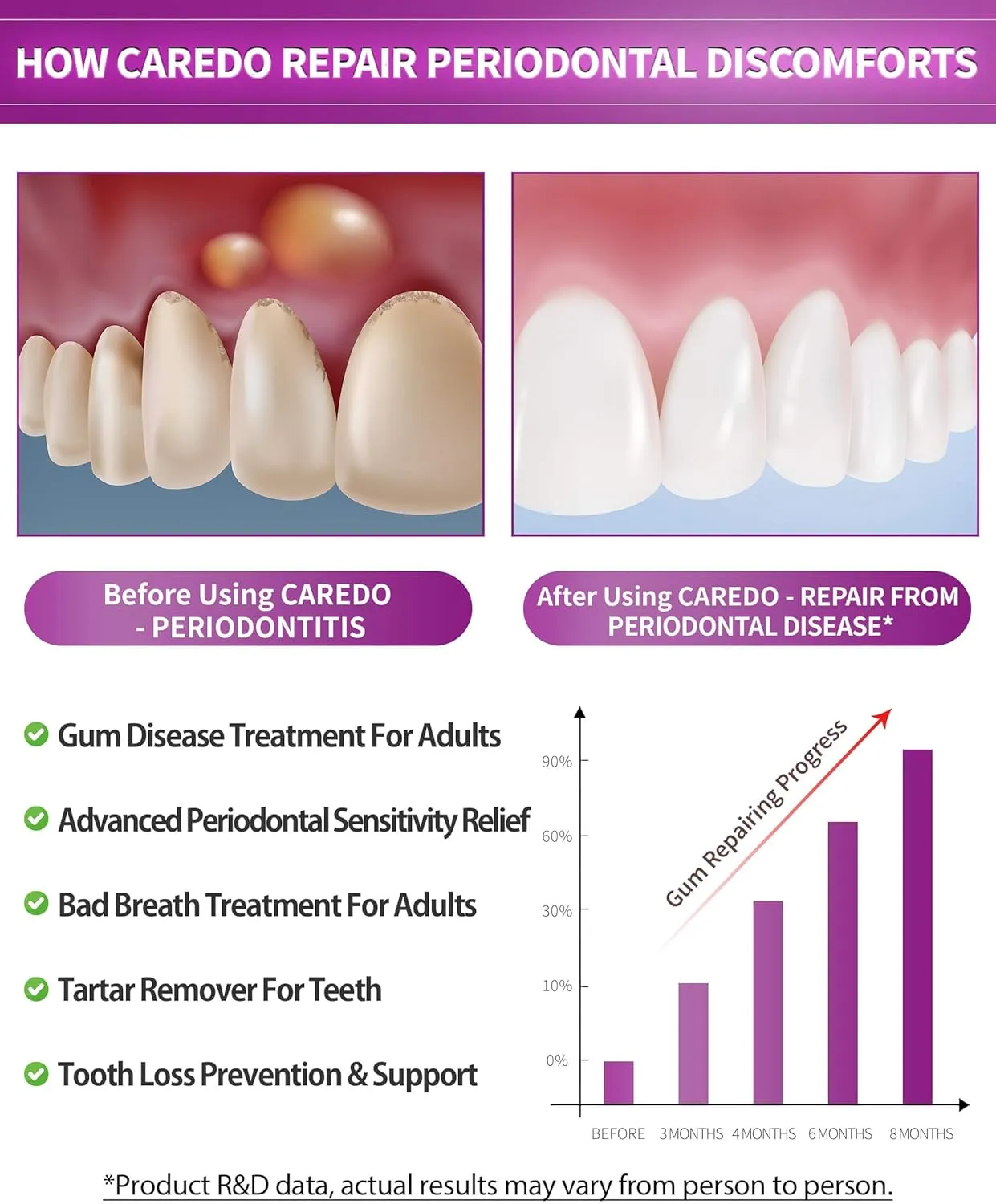 Gum Toothpaste for Periodontitis, Gum Repair for Receding Gums, Gum Disease & Gingivitis Treatment, Periodontal Disease Treatment for Gum Health, Gum Disease Repair Bad Breath Toothpaste 3.52OZ