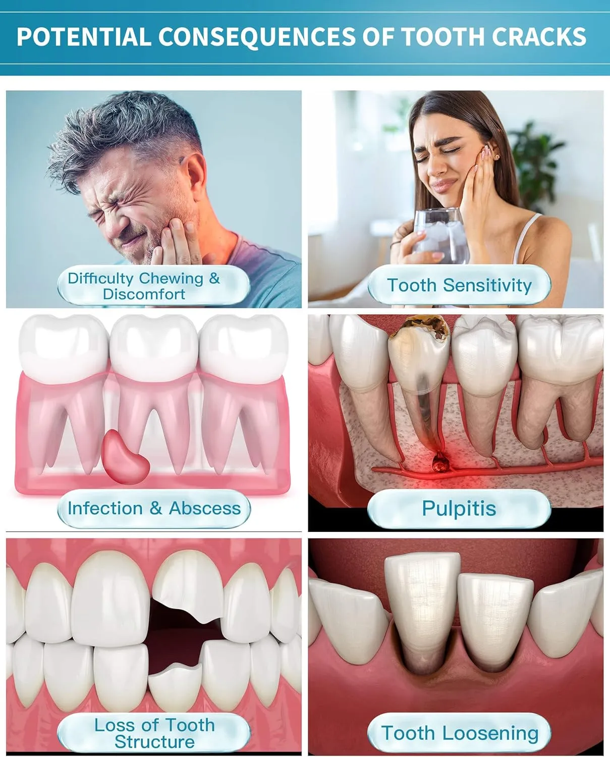 Healing Teeth Crack Toothpaste - Repairing Cracked Teeth Enamel, Remineralizing Toothpaste 100g