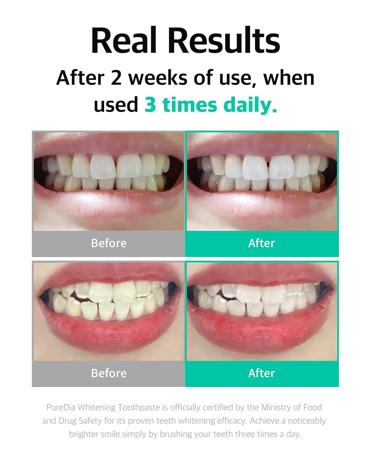 Live Orals Whitening Toothpaste 80g x 5 Units - Fluoride-Free Stain Removal, Strengthens Enamel, Natural Ingredients, Fresh Mint Flavor