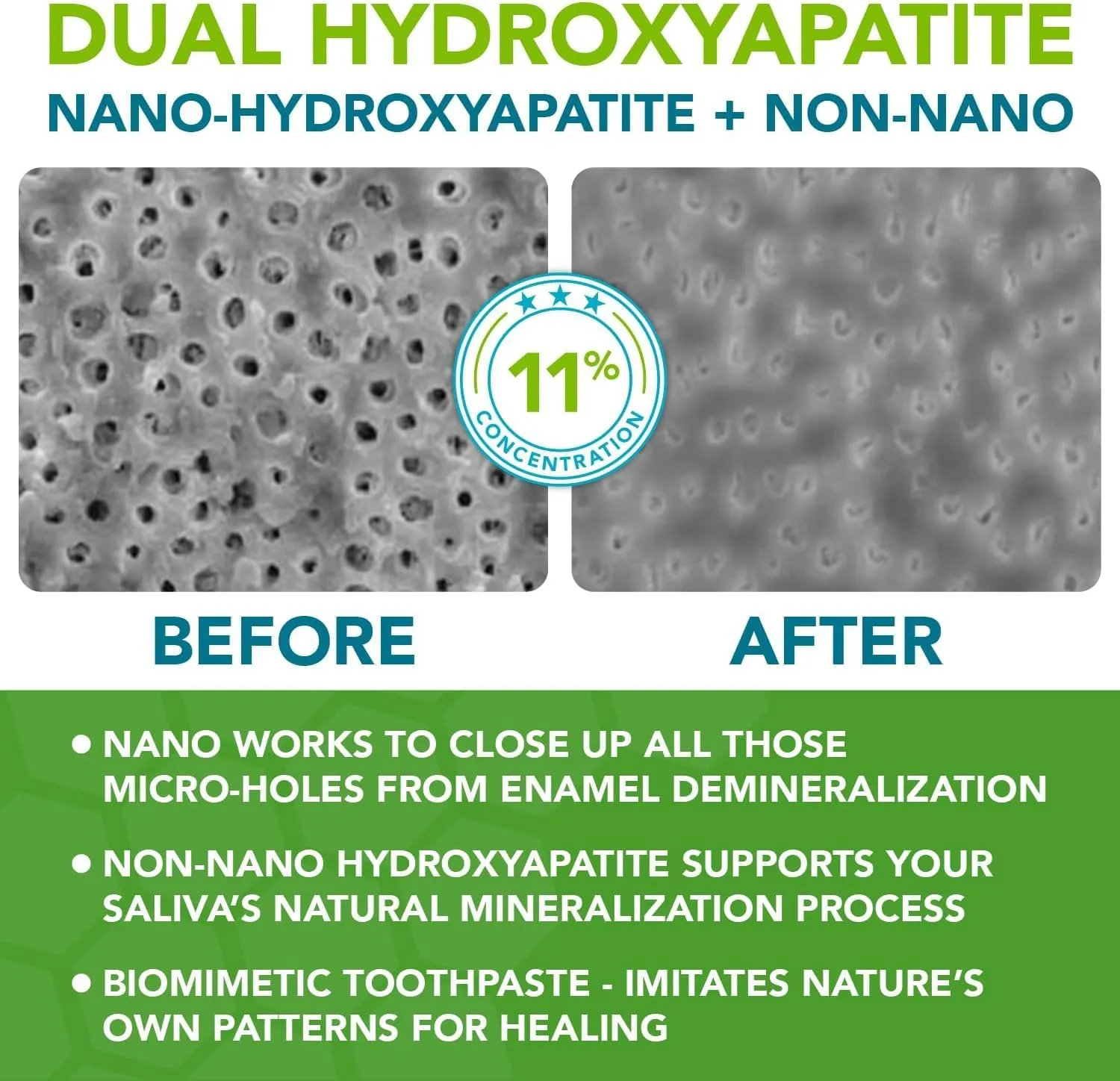 Nano hydroxyapatite Toothpaste Fluoride Free | Pro Remineralizing Toothpaste Plus Anti Cavity Xylitol – Dentist Formulated Tooth Remineralization for Sensitive Teeth & Enamel Support in Wintermint