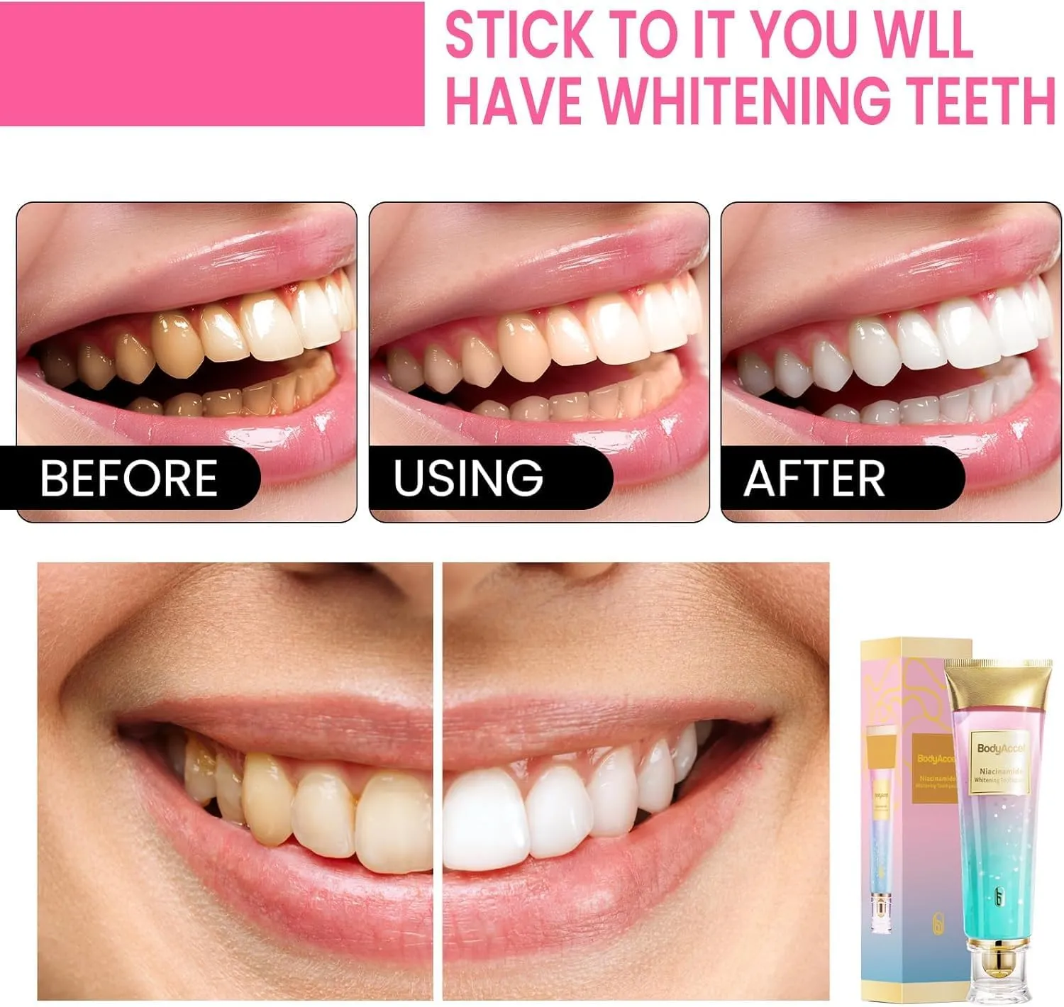 Niacinamide Whitening Toothpaste, BodyAccel Niacinamide Toothpaste, BodyAccel Toothpaste, Stain Removal Triple Whitening Toothpaste Natural Gentle, Fresh Breath