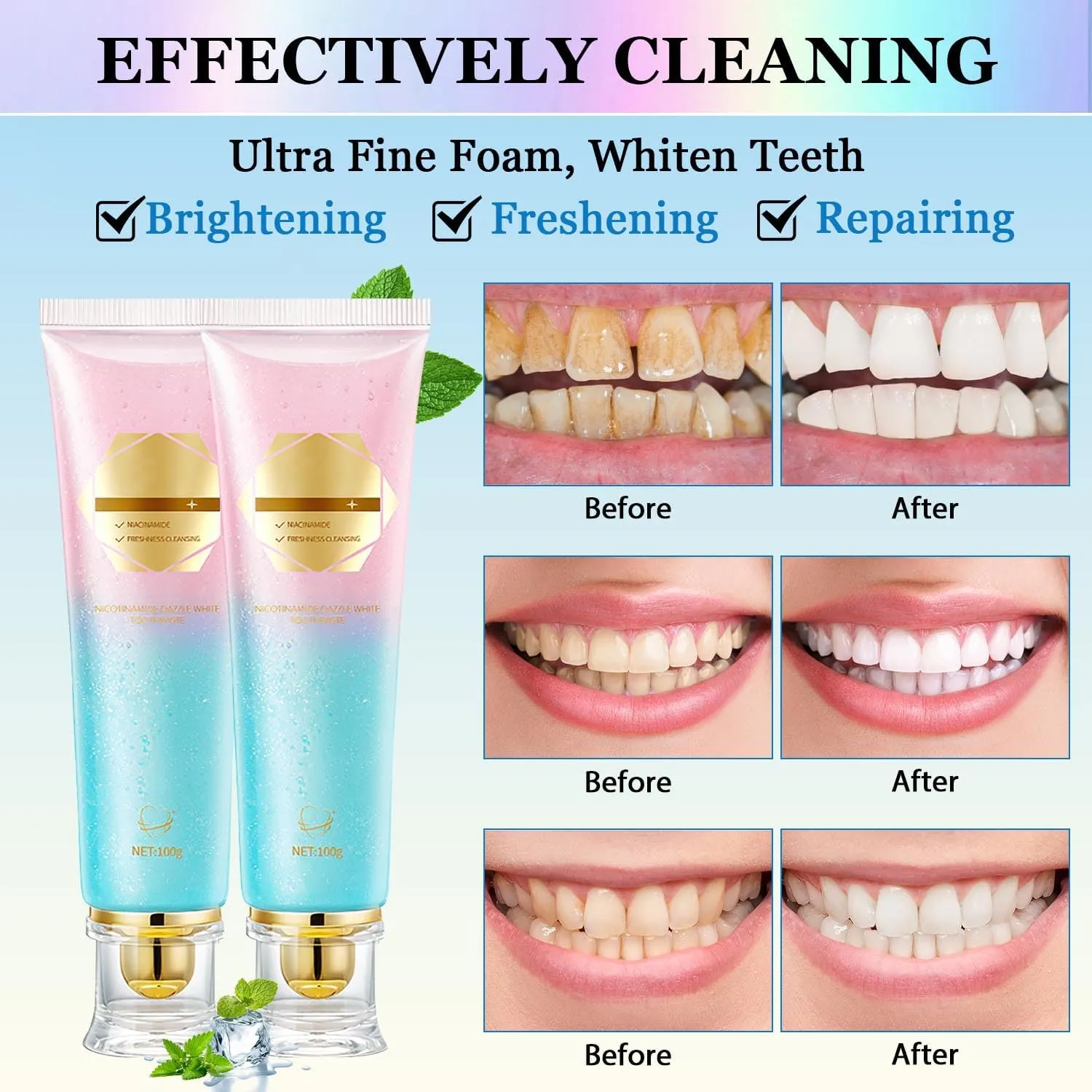 Niacinamide Whitening Toothpaste, Easilyous Radiant White Toothpaste, Niacinamide Intensive Whitening Toothpastes, Fresh Breath, Remove Tooth Stains, 2 PCS
