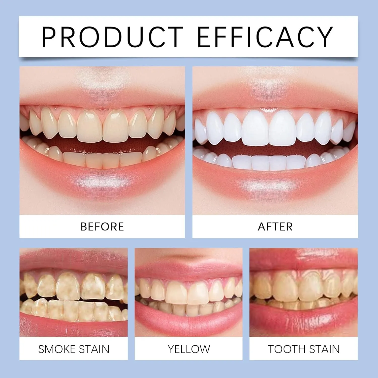 Niacinamide Whitening Toothpaste, Intensive Whitening, Gentle Mint, Breath Freshening, Remove Tartar and Tooth Strengthening (2)