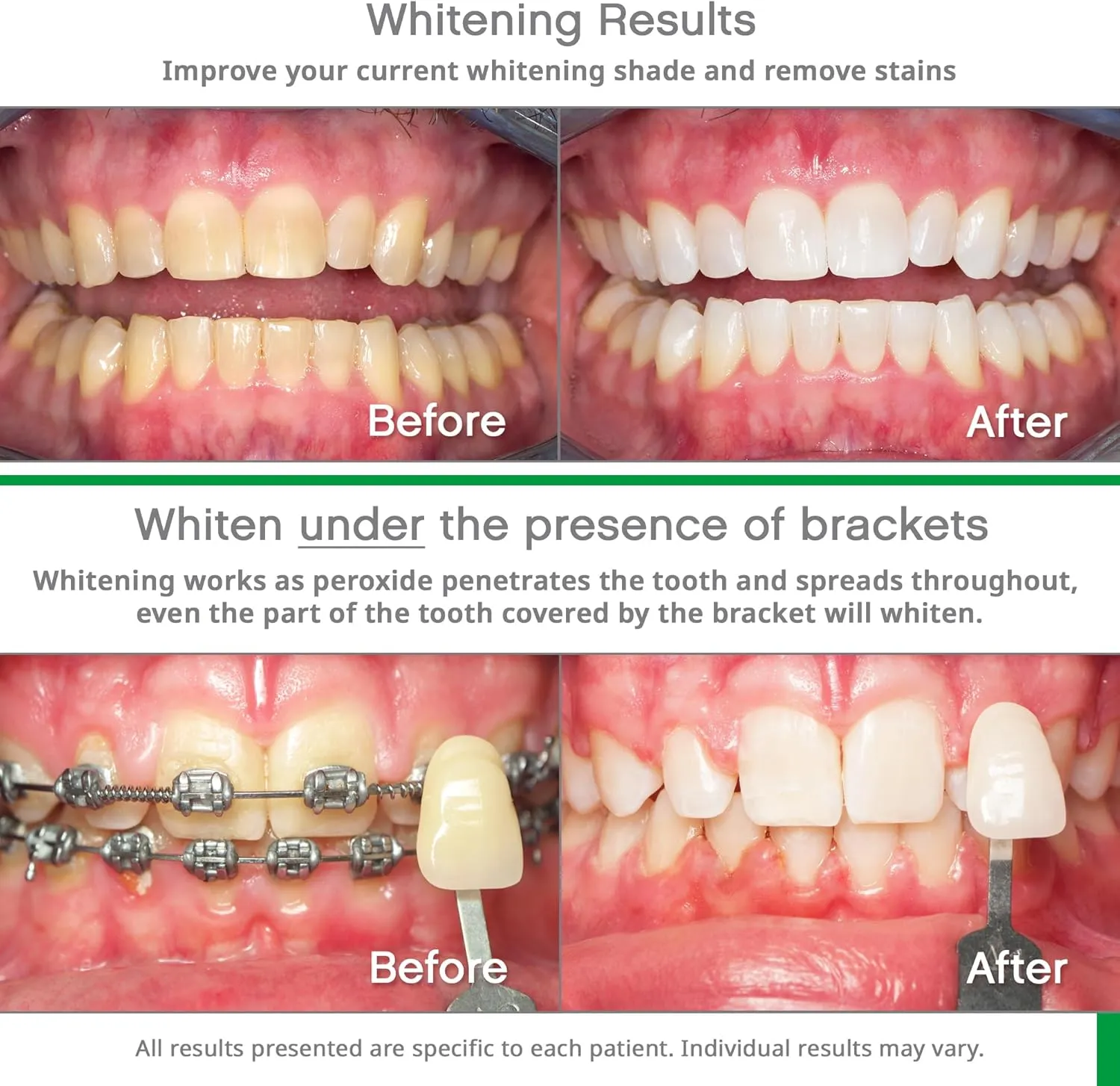 Opalescence Whitening Bundle - Opalescence Go 15% Hydrogen Peroxide Prefilled Whitening Trays and Whitening Toothpaste - Mint Flavor 5194-5166