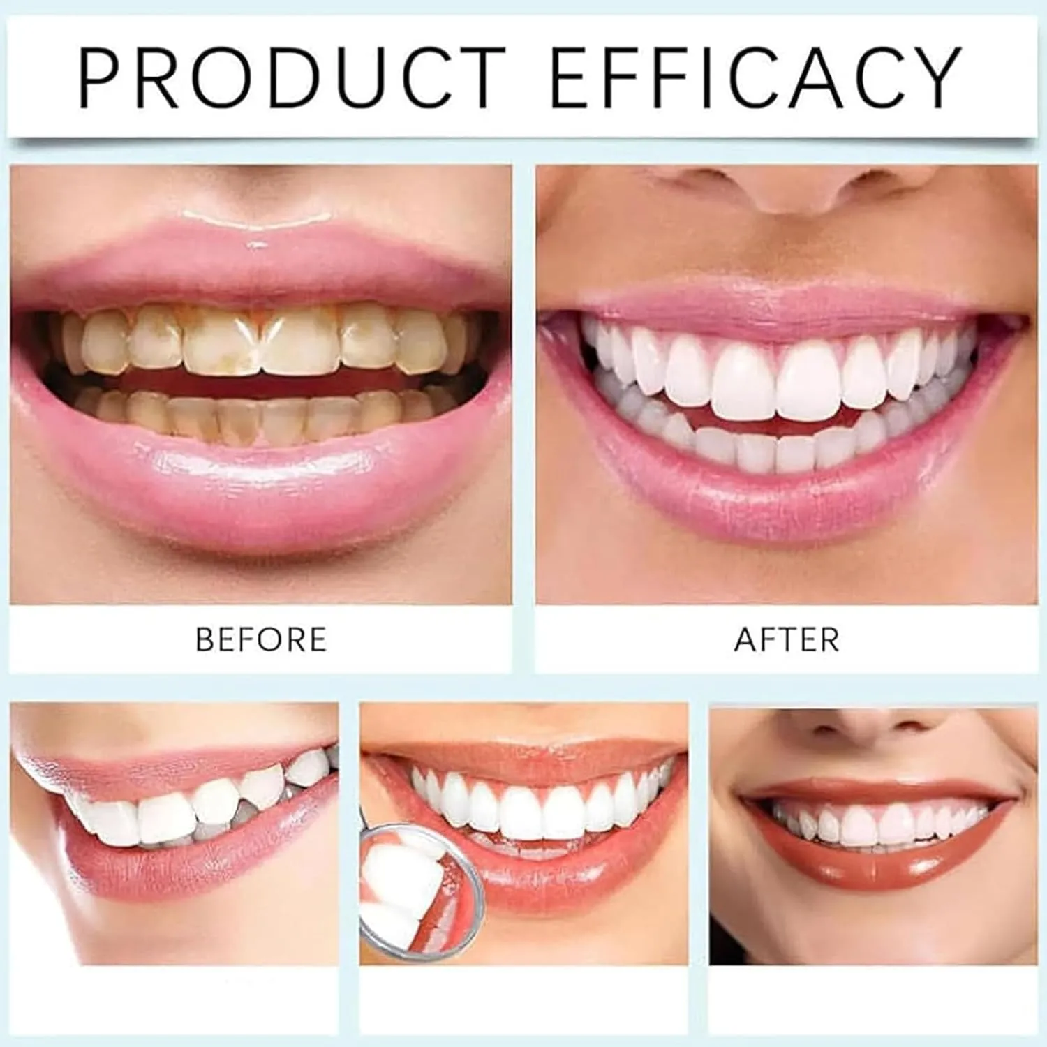 Peachloft Teeth Whitening Toothpaste, Jiorniee/Rovaxz/Shopellox Niacinamide Toothpaste, Fluoride-Free, Removes Stains, Strengthens Enamel, Freshens Breath, Gentle Formula (5.3ounce, 3Pcs)