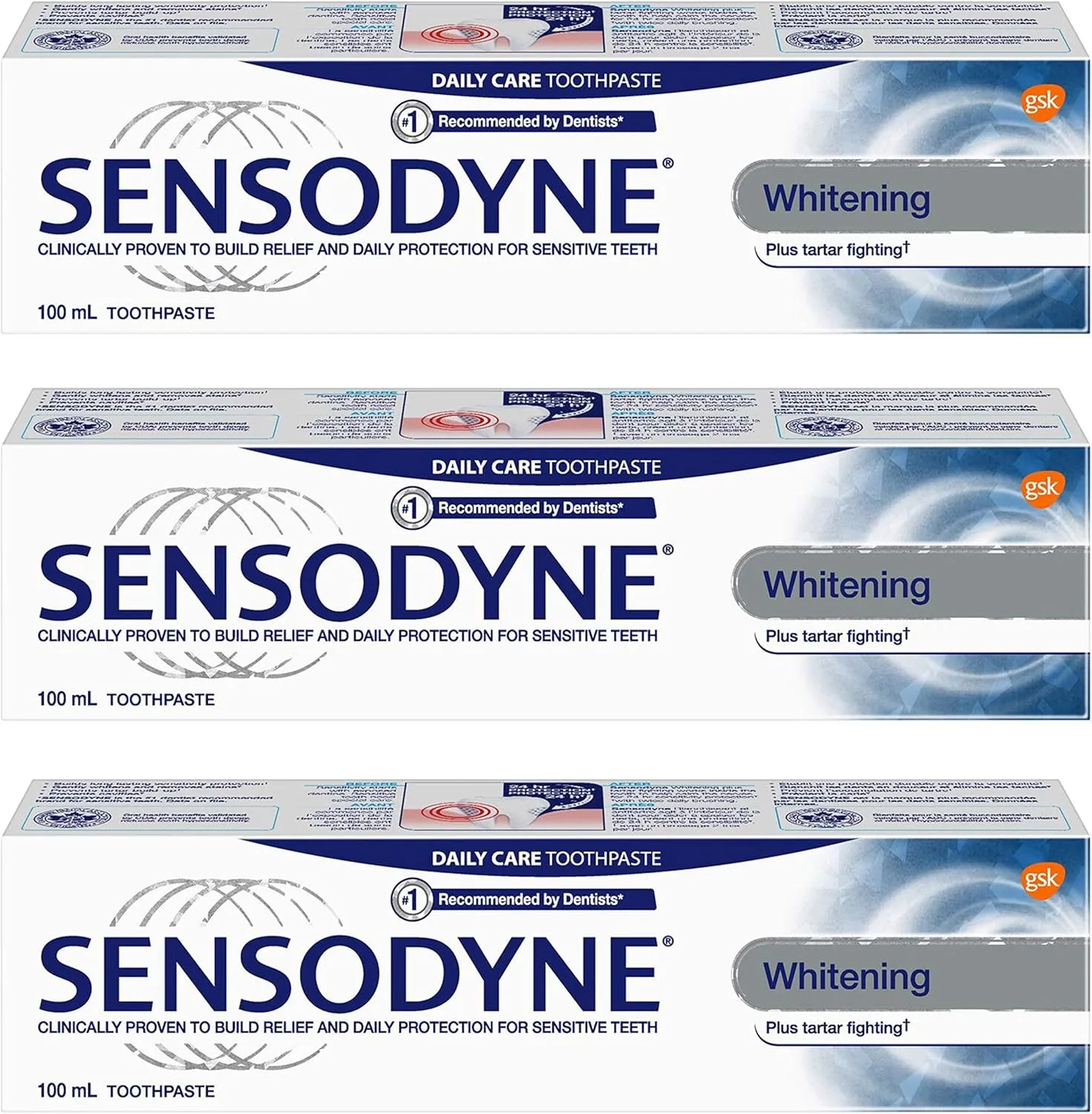 Sensodyne Sensitivity Toothpaste for Sensitive Teeth, Whitening Plus Tartar Control, 100ml (Pack of 3)