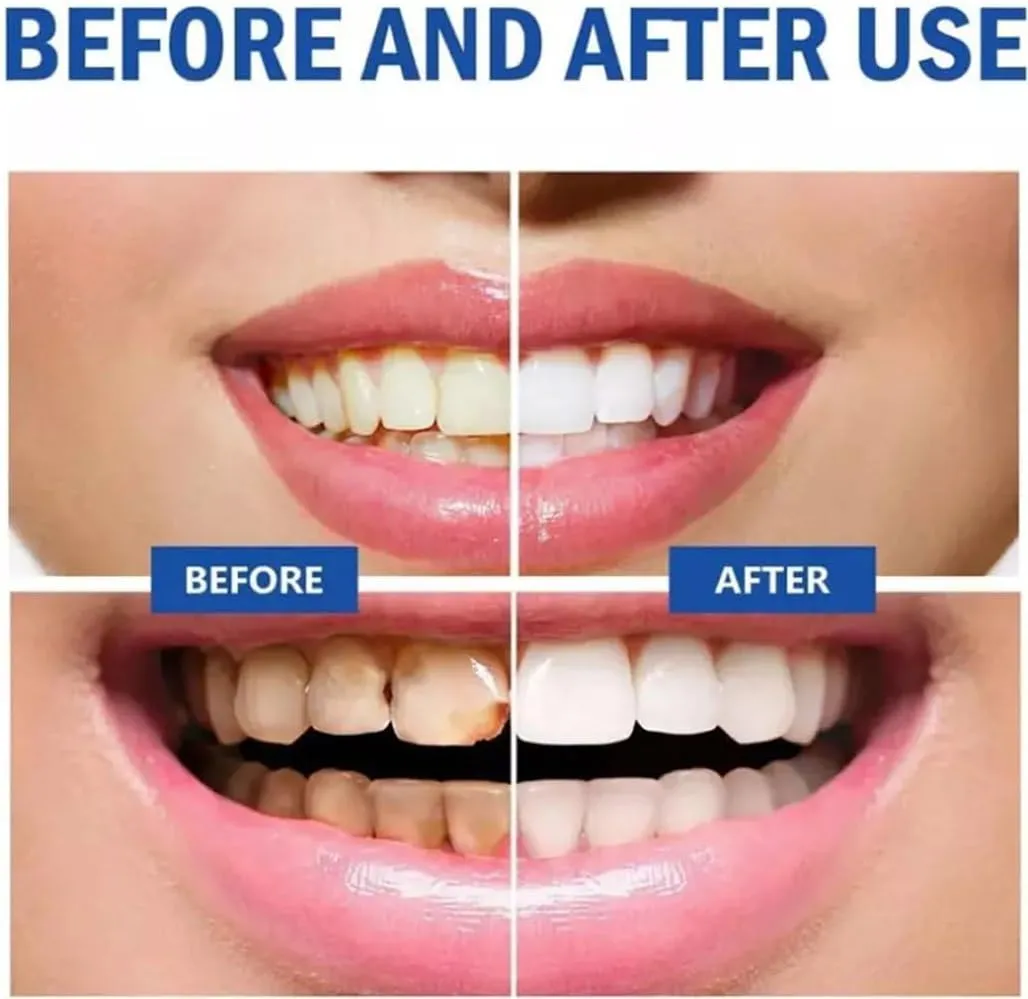 SP 10 Probiotic Toothpaste for Whitening & Gum Health – Natural Fluoride-Free Formula for Fresh Breath & Oral Hygiene