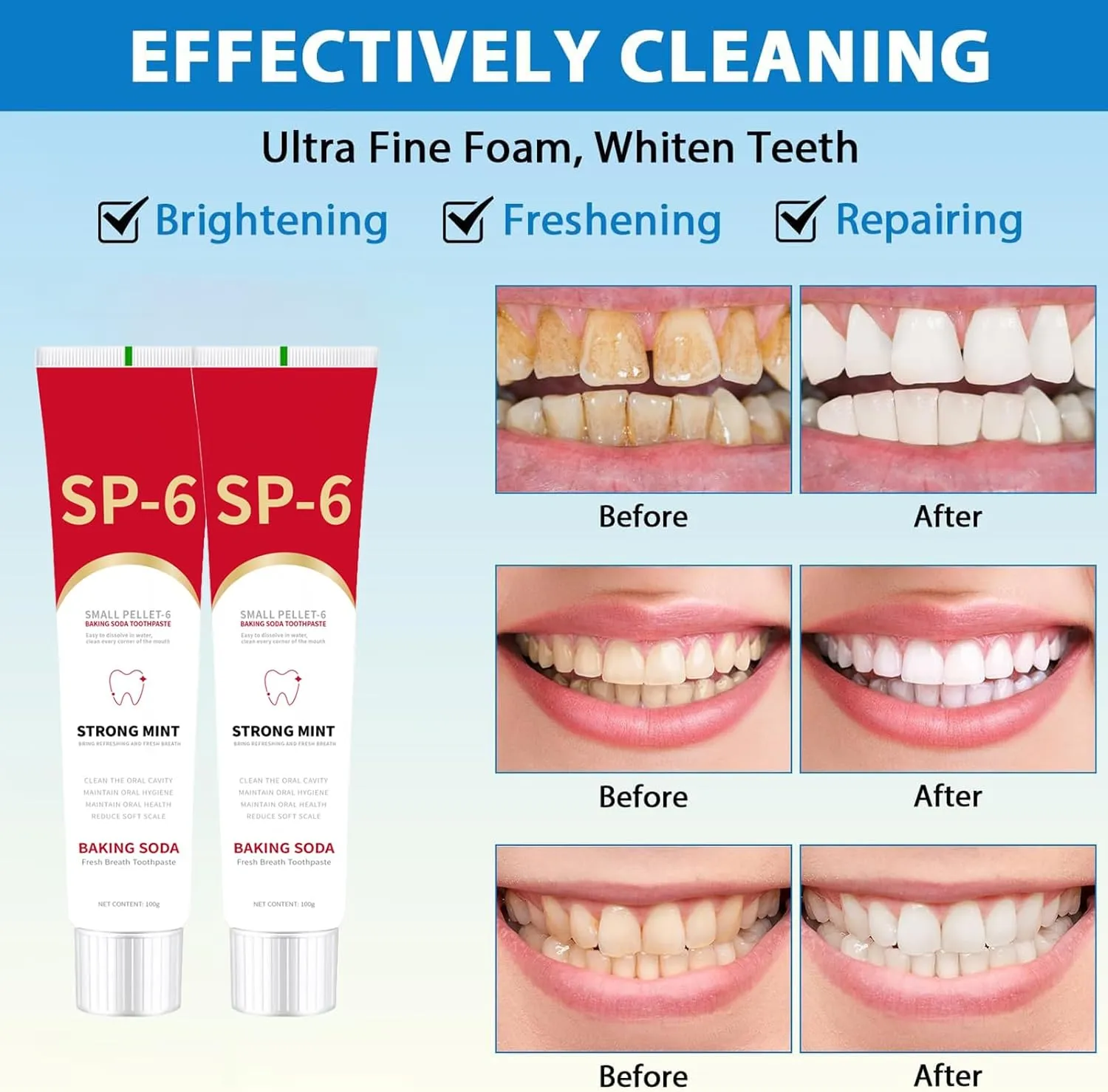 SP-6 Ultra Whitening Toothpaste Sp-6 Probiotics Whitening Toothpaste Sp6 Probiotic Brightening Deep Cleaning Fresh Breath Promotes Healthy Teeth and Gums (5PCS)