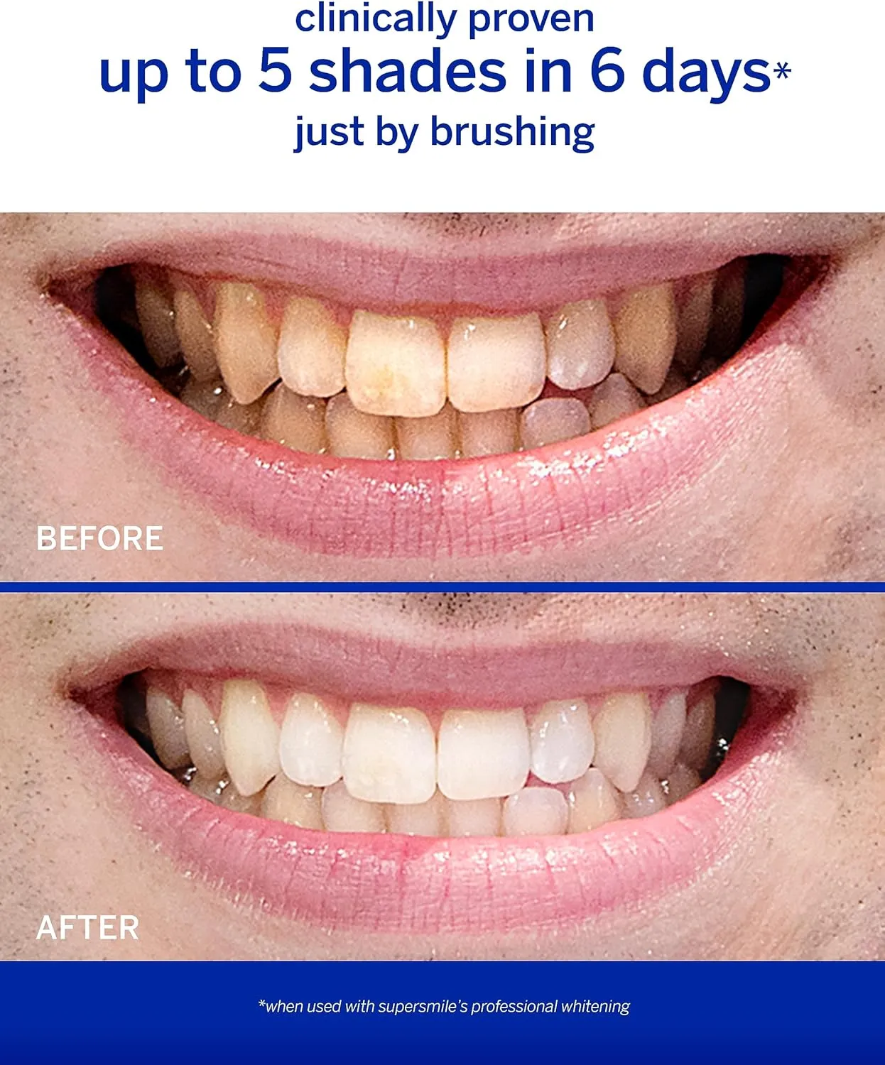 Supersmile Rosewater Mint whitening Toothpaste with Fluoride – Professional Formula for Brighter Teeth – Whitens Up to 6 Shades, 8 oz