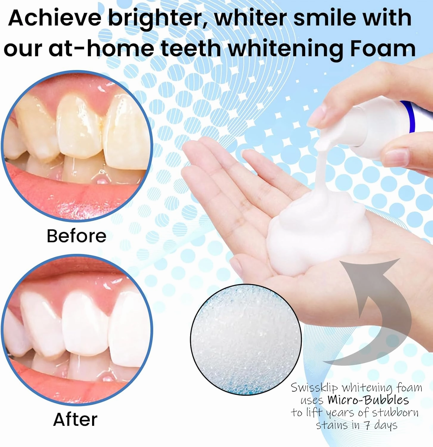 Swissklip Teeth Whitening Foam Toothpaste Also a Teeth Whitener in The Market I We Offer Best Teeth Whitening Products for Professional Teeth Whitening Kit (3)