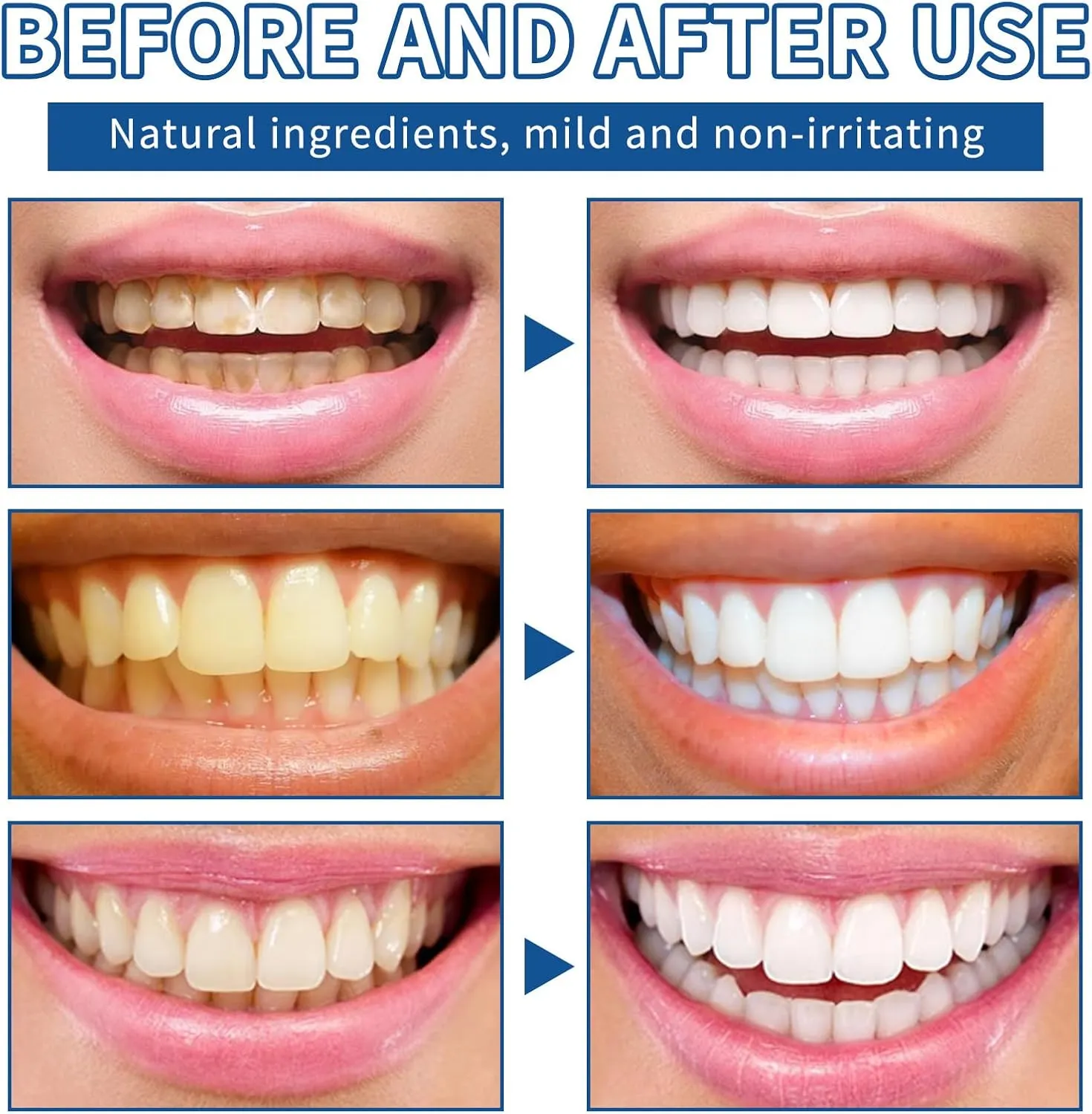 Teeth Whitening Powder,Coconut Activated Charcoal Whitening Toothpaste Booster,Tooth Restoration Mineral Powder Whitener (35g*3, Mild Mint)