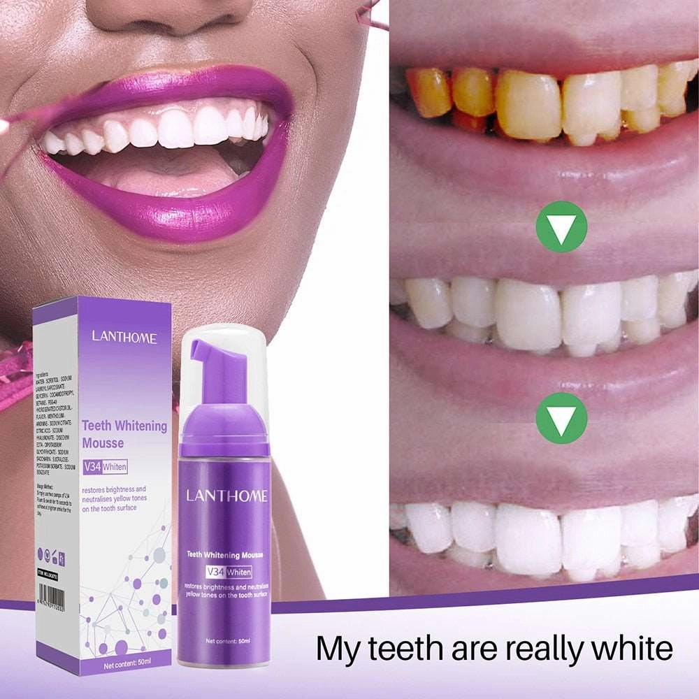 Teeth Whitening Mousse