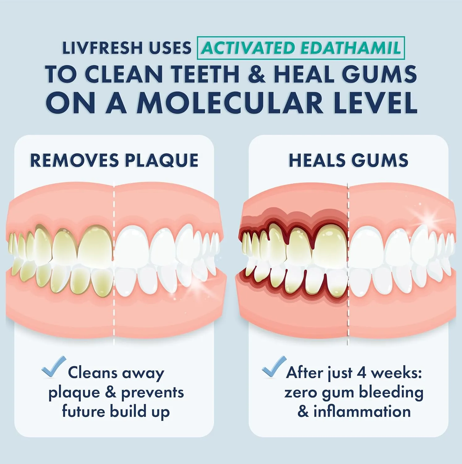 Toothpaste Gel, Clinically Proven to Remove Plaque 250% Better, Improves Gum Health 190% Better, Prevents & Reduces Tartar, Mild Peppermint