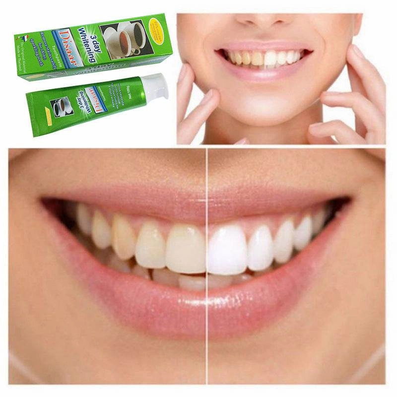 Toothpaste for tea stains