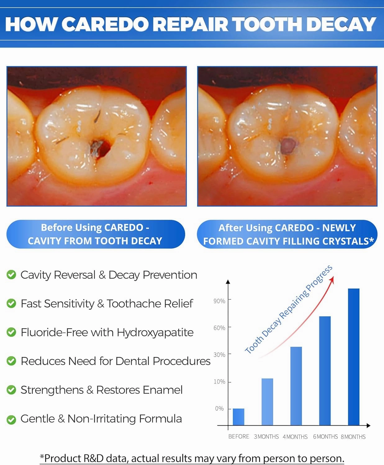 Upgraded Taste - CAREDO Cavity Reversal Hydroxyapatite Toothpaste for Adults, Cavity Tooth Filler as Remineralizing Home Cavity Repair, Fluoride Free Reverse Cavities for Tooth Decay Repair, 2-Pack